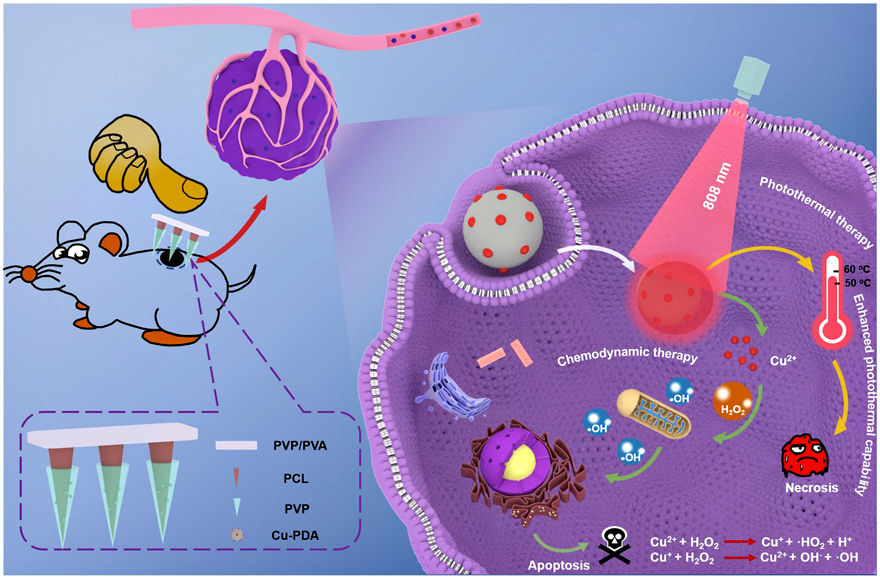 PLA微针实现公斤级制备，中新康明加速经皮给药系统商业化进程