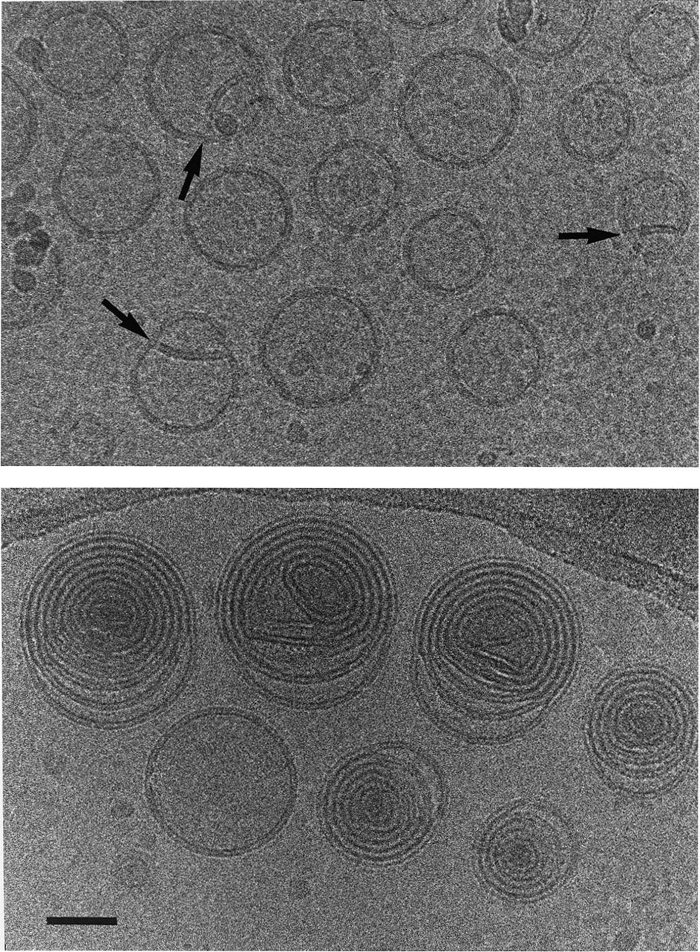 脂质体配方优化 脂质体配方优化