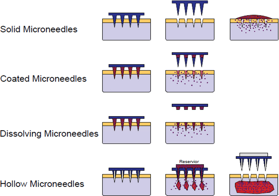 聚合物微针 聚合物微针