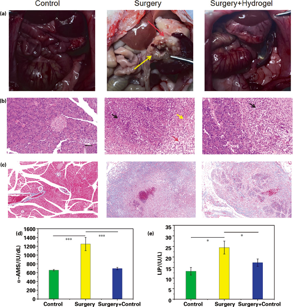 负载MXene纳米片的冻融水凝胶的制备及防治术后胰瘘的研究 负载MXene纳米片的冻融水凝胶的制备及防治术后胰瘘的研究