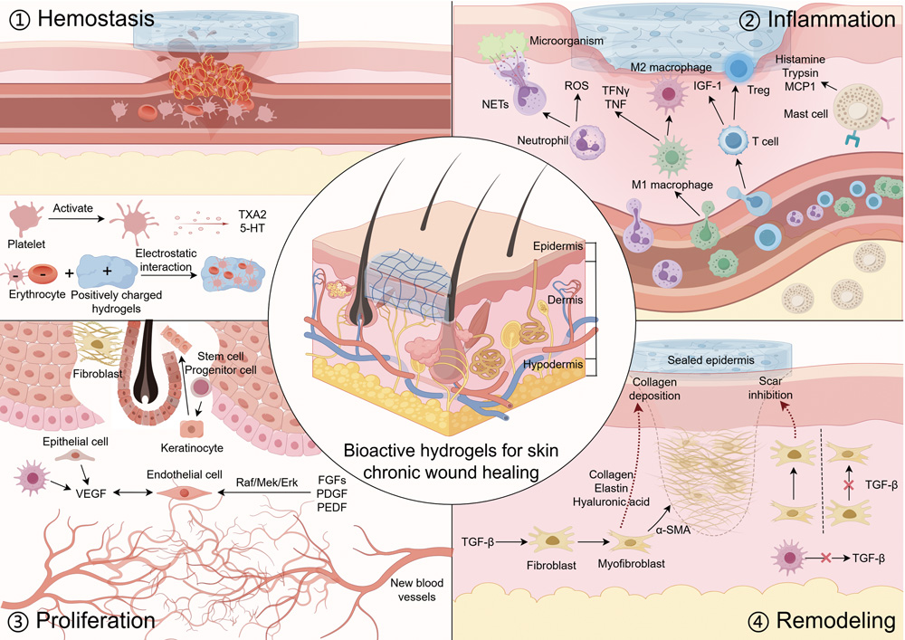 生物活性水凝胶通过调控细胞行为促进皮肤慢性创面愈合-7