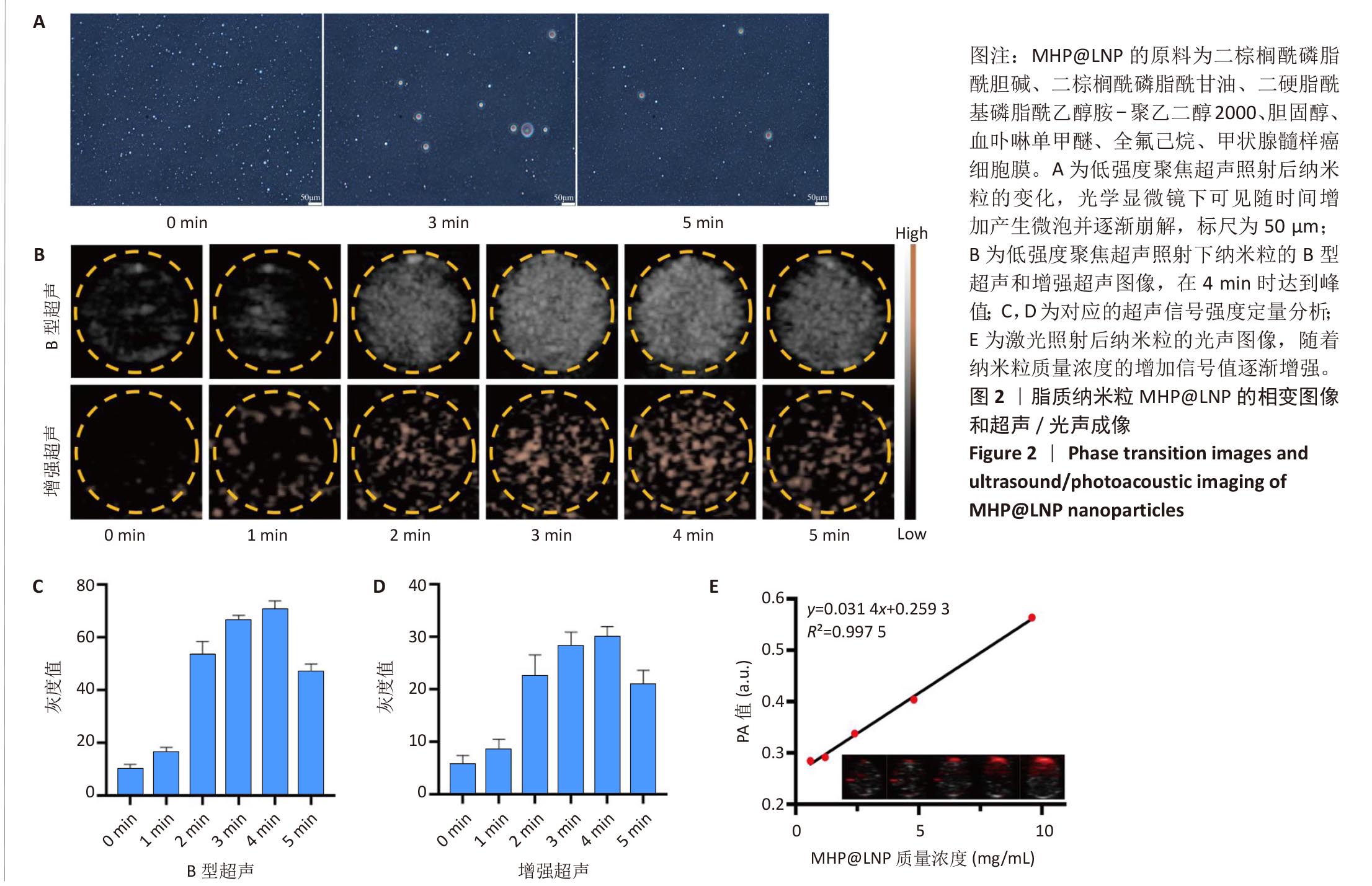 双模态成像仿生纳米粒对甲状腺髓样癌的声动力治疗-4