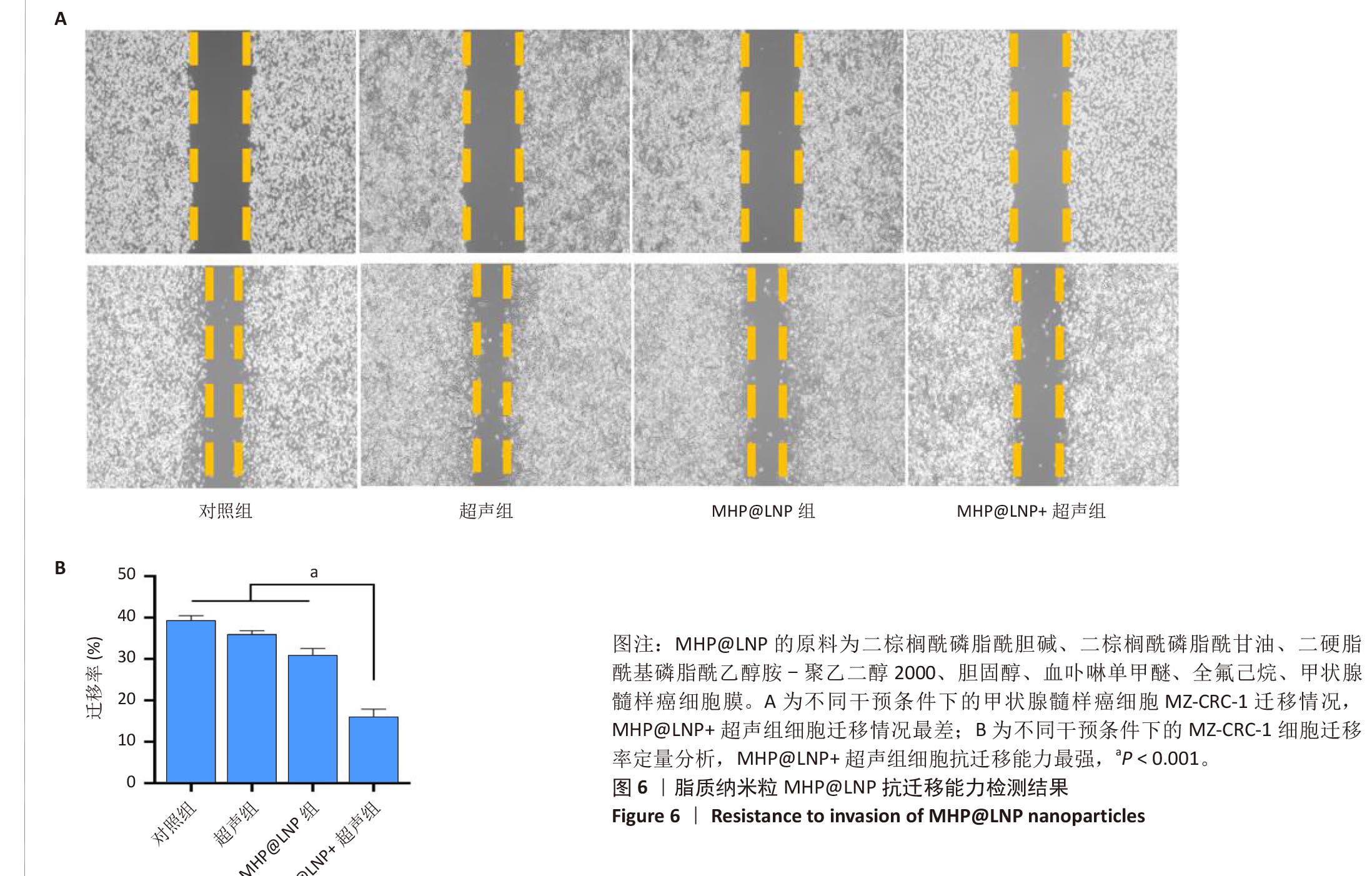 双模态成像仿生纳米粒对甲状腺髓样癌的声动力治疗-9
