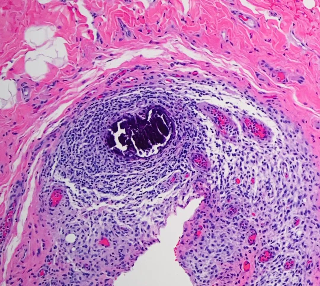 AC14B03201834B940A73CD2F6DF1E5FB AC14B03201834B940A73CD2F6DF1E5FB