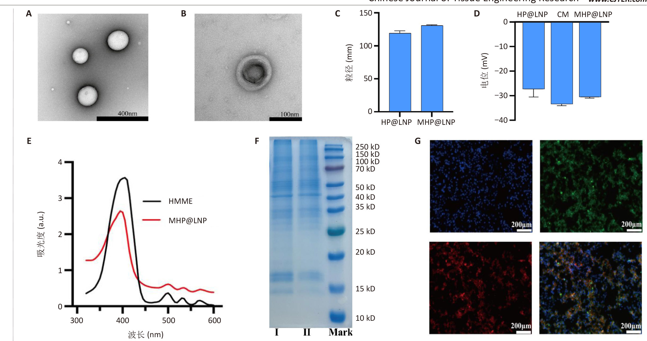 双模态成像仿生纳米粒对甲状腺髓样癌的声动力治疗-6 双模态成像仿生纳米粒对甲状腺髓样癌的声动力治疗-6