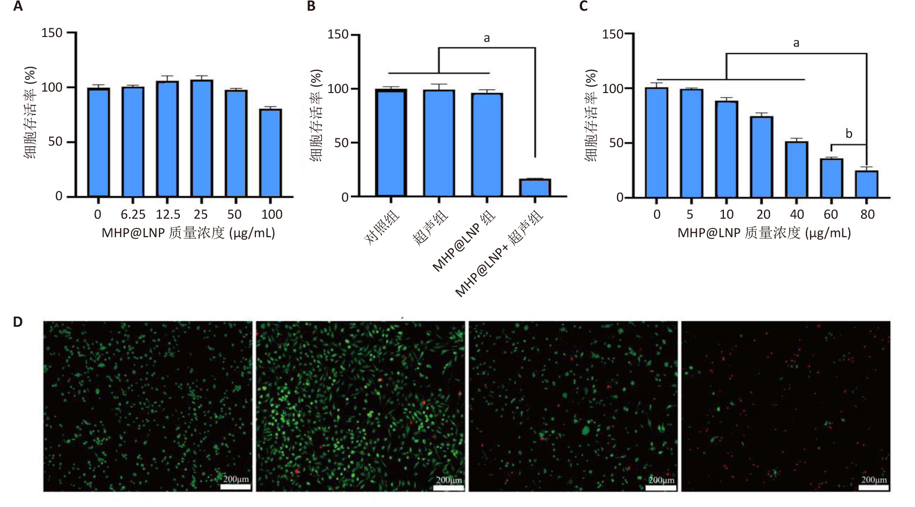 双模态成像仿生纳米粒对甲状腺髓样癌的声动力治疗-8 双模态成像仿生纳米粒对甲状腺髓样癌的声动力治疗-8