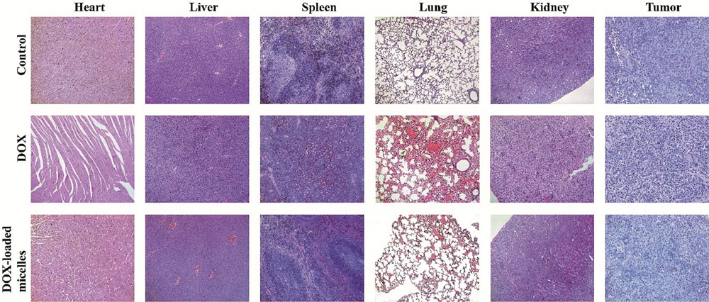 pH-Responsive-hyperbranched-polypeptides-based-on-Schiff-bases-as-drug-carriers-for-reducing-toxicity-of-chemotherapy-19